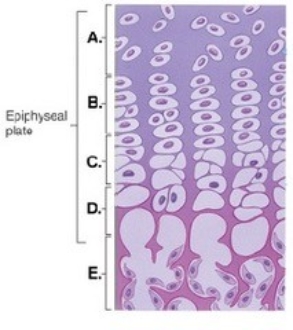 -This figure illustrates bone growth in length at the epiphyseal plate. Zone B represents