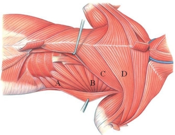 Identify the serratus ventralis in the following image.  