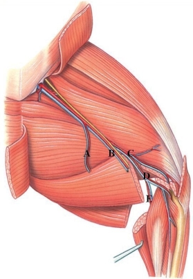 <strong>Identify the deep popliteal artery in the figure. </strong> A) A B) B C) C D) D E) E