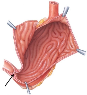 <strong>Identify the structure at the tip of the arrow in this figure. </strong> A) anal sphincter B) pyloric sphincter C) lower esophageal sphincter D) ileocecal sphincter