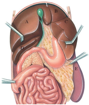 <strong>Identify the left medial lobe of the liver in the following figure. </strong> A) A B) B C) C D) D E) E