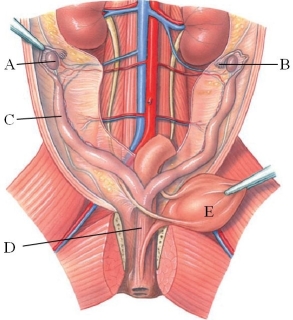 <strong>Identify the ovary in the following figure. </strong> A) A B) B C) C D) D E) E