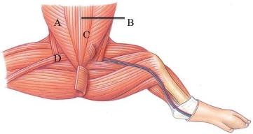 <strong>Identify the linea alba in the following figure. </strong> A) A B) B C) C D) D