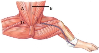 <strong>Identify the rectus abdominis in the following figure. </strong> A) A B) B C) C D) D