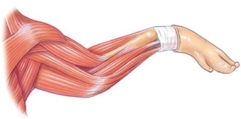 <strong>Identify the extensor carpi radialis in the following figure. </strong> A) A B) B C) C D) D E) E