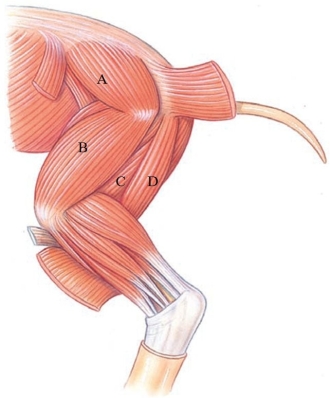 <strong>Identify the semimembranosus in the following figure. </strong> A) A B) B C) C D) D