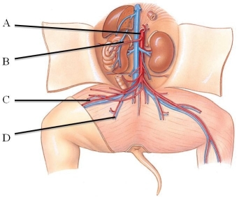 <strong>Identify the deep femoral artery in the following figure. </strong> A) A B) B C) C D) D E) E