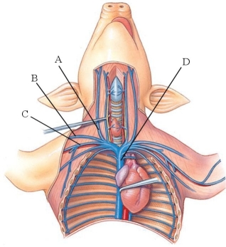 <strong>Identify the right cephalic vein in the following figure. </strong> A) A B) B C) C D) D