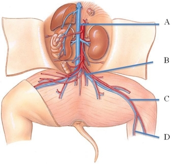 <strong>Identify the external iliac vein in the following figure. </strong> A) A B) B C) C D) D