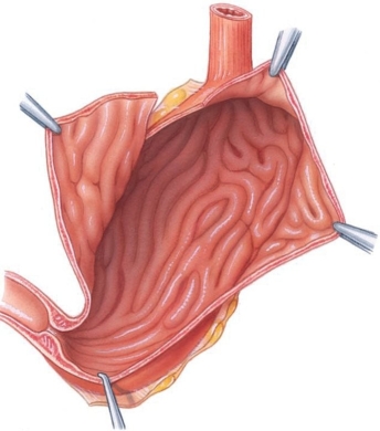 <strong>The large folds of the stomach mucosa (shown here) are called ________. </strong> A) villi B) rugae C) papillae D) mesentery