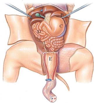 <strong>Identify the gallbladder in the following figure. </strong> A) A B) B C) C D) D E) E