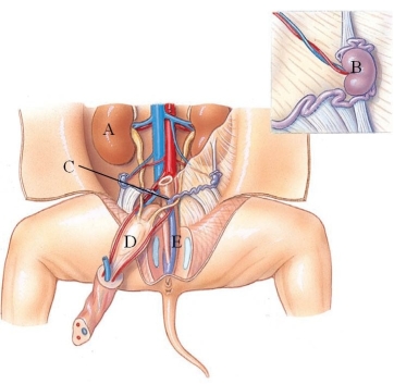 <strong>Identify the urinary bladder in the following figure. </strong> A) A B) B C) C D) D E) E
