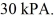 Molar heat capacities: The temperature of an ideal gas in a sealed 0.40 container is reduced from 400 K to The final pressure of the gas is The molar heat capacity at constant volume of the gas is 28.0 J/mol · K. The work done by the gas is closest to