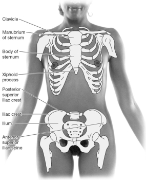 Place an X over the preferred site of a bone marrow biopsy.