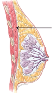 <strong>In this image of the female breast, the line points to the </strong> A) adipose tissue B) lobule containing alveoli C) pectoralis major muscle D) milk duct E) areola