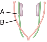 <strong>The image below shows undifferentiated internal reproductive structures. In a male, what will structure A differentiate into? </strong> A) vas deferens B) gonads C) fallopian tubes D) Sertoli cells E) rete testes