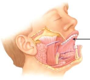 <strong>Identify the structure indicated in the image below. </strong> A) uvula B) tongue C) teeth D) lips E) cheek