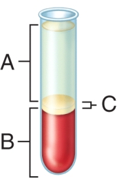 <strong>Identify a cellular component found in region A shown in the image.  </strong> A) neutrophil B) stem cell C) platelet D) monocyte E) fibrinogen <div style=padding-top: 35px> 
