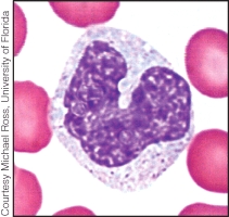 <strong>Identify the type of leukocyte shown in the image.  </strong> A) lymphocyte B) eosinophil C) basophil D) neutrophil E) monocyte <div style=padding-top: 35px> 