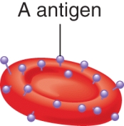 A person whose erythrocytes are as seen in the image below is likely to have a blood group of type AB.  <div style=padding-top: 35px> 