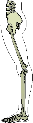 <strong> Which of the following knee postures is depicted in the image?</strong> A)Valgus B)Recurvatum C)Varus D)Torsion
