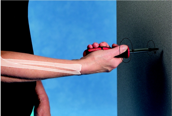 -What is the function of the triceps as shown in the image as the screwdriver is used to tighten a screw?