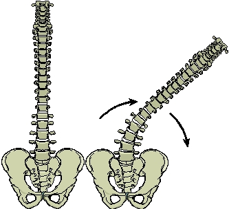 -What motion is MOST OFTEN coupled with lateral flexion of the spine in the image?