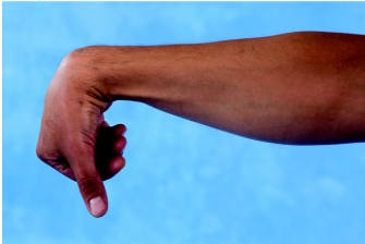 -The hand has a decreased ability to produce a powerful grip in the position as shown in the image.Why is this ability decreased?