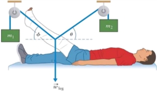 Figure 4.7 The leg and cast in Fig. 4.7 have mass m<sub>leg</sub> = 30 kg. Determine the mass of object m<sub>2</sub> and the angleè for the system in balance. Mass m<sub>1</sub> = 10 kg and ö = 30°.