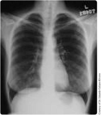 Figure 24.1 Anterior chest X-ray of a normal, middle-aged, female subject. Discuss briefly the dependence of the colour of various media in Fig. 24.1 on photoelectric absorption.