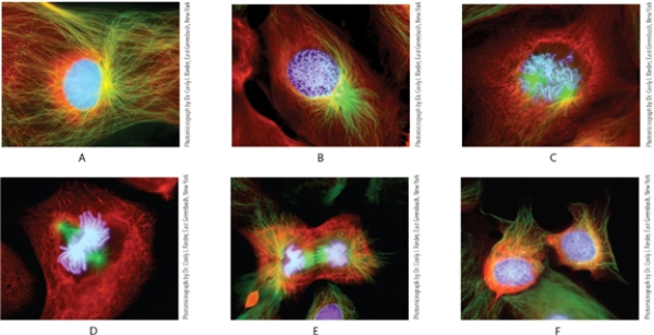 <strong>Figure 7-1 Photomicrograph by Dr. Conly L. Rieder, East Greenbush, New York Which stage of mitosis is depicted in photo A in Figure 7-1?</strong> A) interphase B) metaphase C) prophase D) anaphase