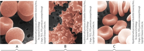 These micrographs of animal cells depict the effects of various aqueous environments on red blood cells placed in a hypotonic, hypertonic, or isotonic environment. Match each term to a micrograph.   ©1976 The Rockefeller University Press. The Journal of Cell Biology, 1976, 70:193-203. doi: 10.1083/jcb.70.1.1 hypertonic<div style=padding-top: 35px> 