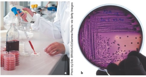 The test below is called a fecal coliform test. Explain what it tests for and what the results show.  <div style=padding-top: 35px> 