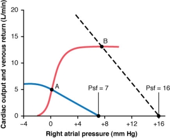 For the cardiac output curve defined by the solid line and the venous return curve defined by the dashed line (with equilibrium at point B), what is the resistance to venous return in units of mm Hg/L/min?