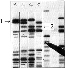<strong>Figure 15-3 Use the figure to answer the corresponding question(s). The columns in Figure 15-3 represent F (for female), C (for children), and M (for male).The presence of the band marked with arrow #1 shows that:</strong> A) this DNA sequence was inherited by both children from their father. B) this DNA sequence was inherited by both children from their mother. C) this DNA sequence was inherited by only one child from the father. D) this DNA sequence was inherited by only one child from the mother. E) individual M is not the father of these children.