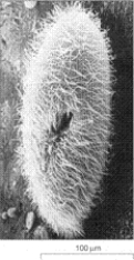 <strong>The accompanying figure is the product of a: </strong> A) phase-contrast light microscope. B) Nomarski differential interference microscope. C) transmission electron microscope. D) scanning electron microscope. E) confocal fluorescence microscope.