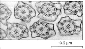 <strong>The structures in the micrograph are: </strong> A) chloroplasts. B) cilia. C) rough ER. D) flagella. E) B and D.