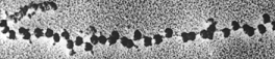 <strong>  The structure in the above figure demonstrates which of the following?</strong> A) transcription and translation occur simultaneously on a single strand B) ribosomes attached to a strand of DNA C) a small ribosomal subunit D) multiple ribosomes on a strand of mRNA E) all of these <div style=padding-top: 35px> 