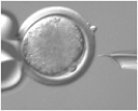 <strong> The above figure represents</strong> A) cloning with a stem cell. B) somatic cell nuclear transfer. C) genetic manipulation of a single gene. D) microsurgical manipulation of a chromosome. E) none of these.