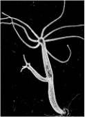 <strong> The organism shown above is using which of the following types of reproduction?</strong> A) asexual budding B) sexual production of eggs C) hermaphroditic co-fertilization D) a combination of all three E) none of these