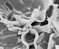 <strong> The tube-like structures extending from these bacterial cells in the picture above to the underlying cells in the above figure are used for</strong> A) attachment. B) locomotion. C) whipping up proteins. D) breathing. E) communication.