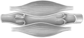 <strong> The greatest volume of blood is found in the</strong> A) aorta and arteries. B) capillaries. C) veins. D) lungs. E) heart.