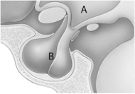 <strong> Pituitary dwarfism may be due to insufficient production of</strong> A) mineralocorticoid. B) glucocorticoid. C) calcitonin. D) GH. E) the parathyroid hormone.