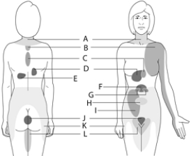 <strong> The above figure shows areas of referred pain that indicate an internal organ is damaged.Which letter corresponds to heart damage?</strong> A) A B) B C) C D) D E) none of these