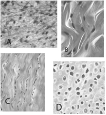 <strong> Bones are held together at joints by</strong> A) tendons. B) intercellular junctions. C) ligaments. D) cartilage. E) collagen.