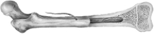 <strong> The figure shown above is of what kind of tissue?</strong> A) blood B) adipose C) bone D) cartilage E) dense connective