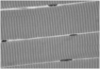 <strong> The above figure is a photomicrograph of what kind of tissue?</strong> A) cardiac muscle B) skeletal muscle C) smooth muscle D) cartilage E) dense connective