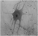 <strong> The above figure is a photomicrograph of what kind of tissue?</strong> A) cardiac muscle B) skeletal muscle C) nerve tissue D) cartilage E) dense connective