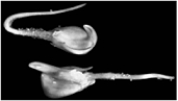<strong> The effect of directional growth shown in the above figure is known to be caused by</strong> A) thigmotropism. B) gravitropism. C) abscisic acid. D) salicylic acid. E) all of these.