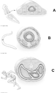 <strong> Use the figure above to answer the following questions. A body plan with a pseudocoelom is indicated by</strong> A) A. B) B. C) C. D) A and B. E) B and C.
